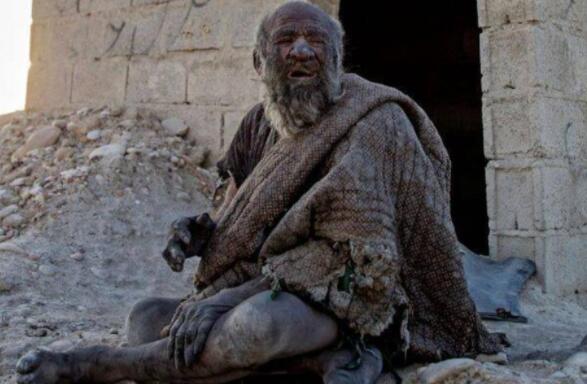 “全球最脏的人”是谁？60多年不洗澡-集忧台