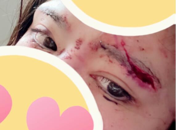 图片[2]-辻井ほのか（辻井穗乃果）发生交通事故，毁容？-集忧台